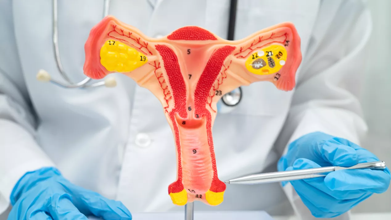 新竹竹北 台中北屯 涵恩婦產科診所 子宮與卵巢常見問題示意圖