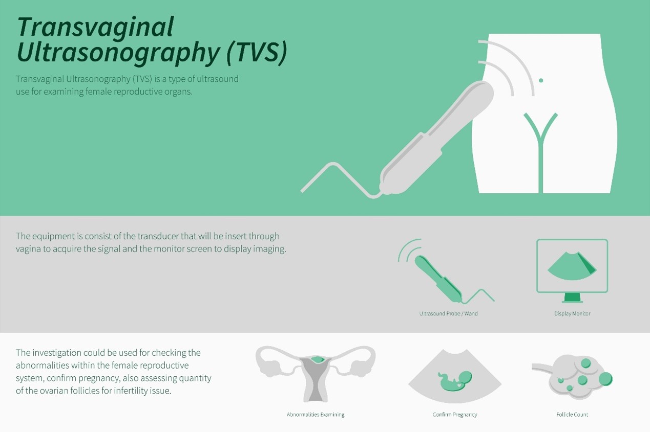 婦產科經陰道超音波與經腹部超音波精準診斷經期異常與子宮病變