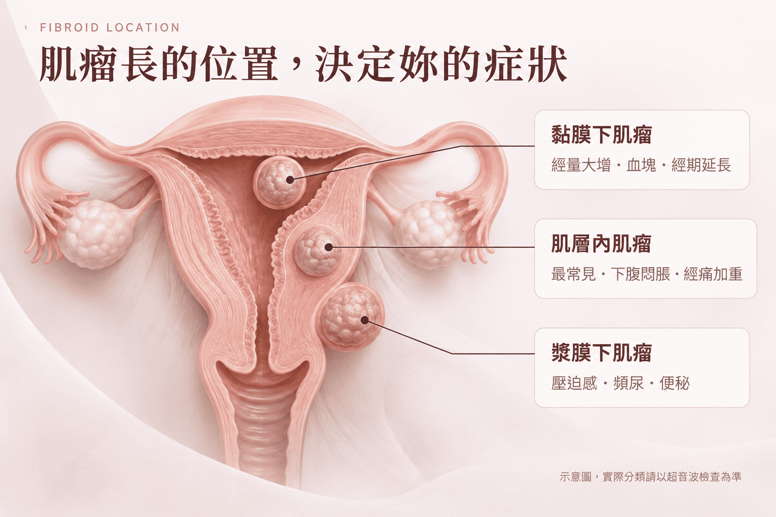 女性坐在窗邊輕撫下腹，思考子宮肌瘤症狀