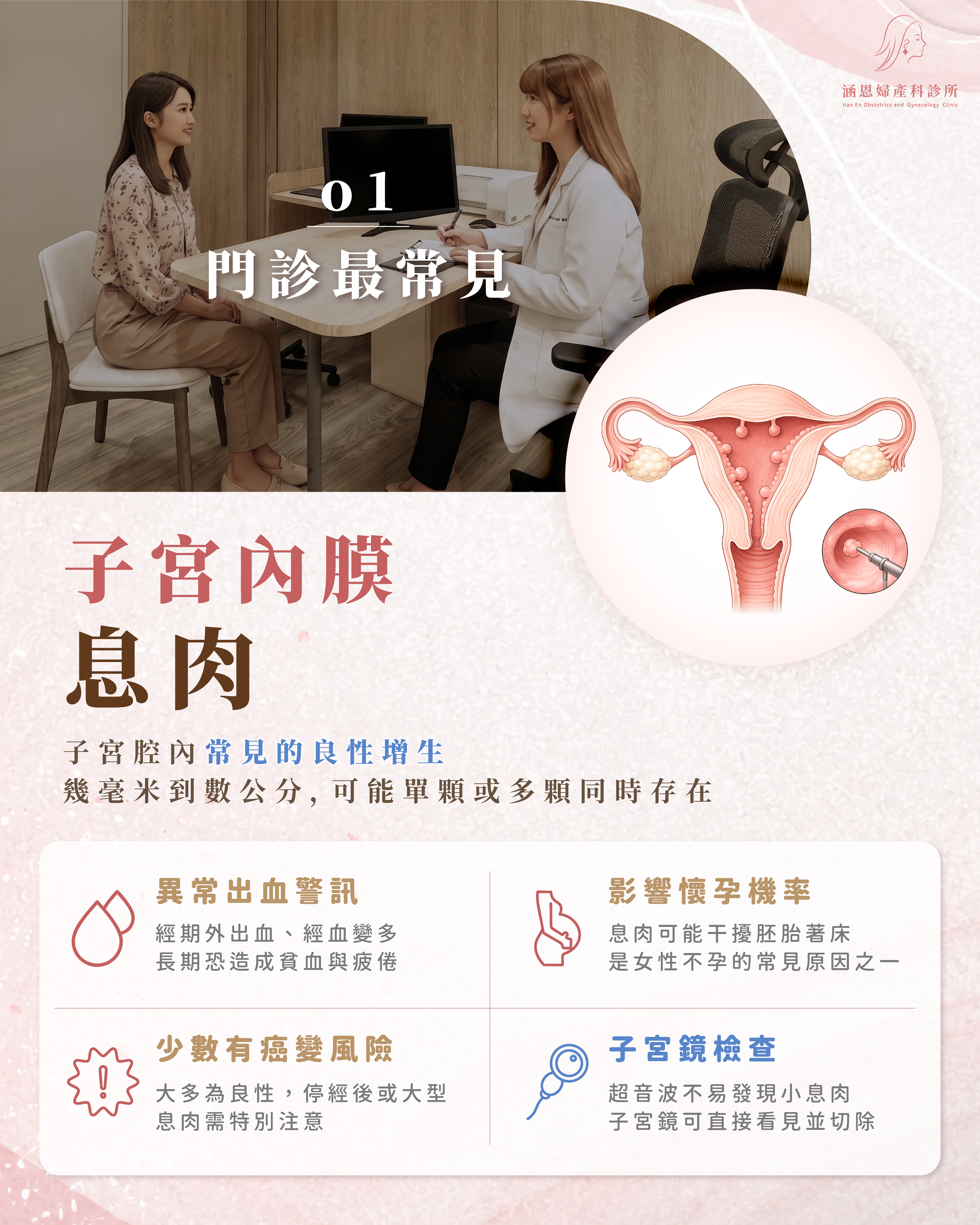 子宮內膜息肉示意圖：子宮腔內多個小型息肉突起，是慢性出血與不孕主因