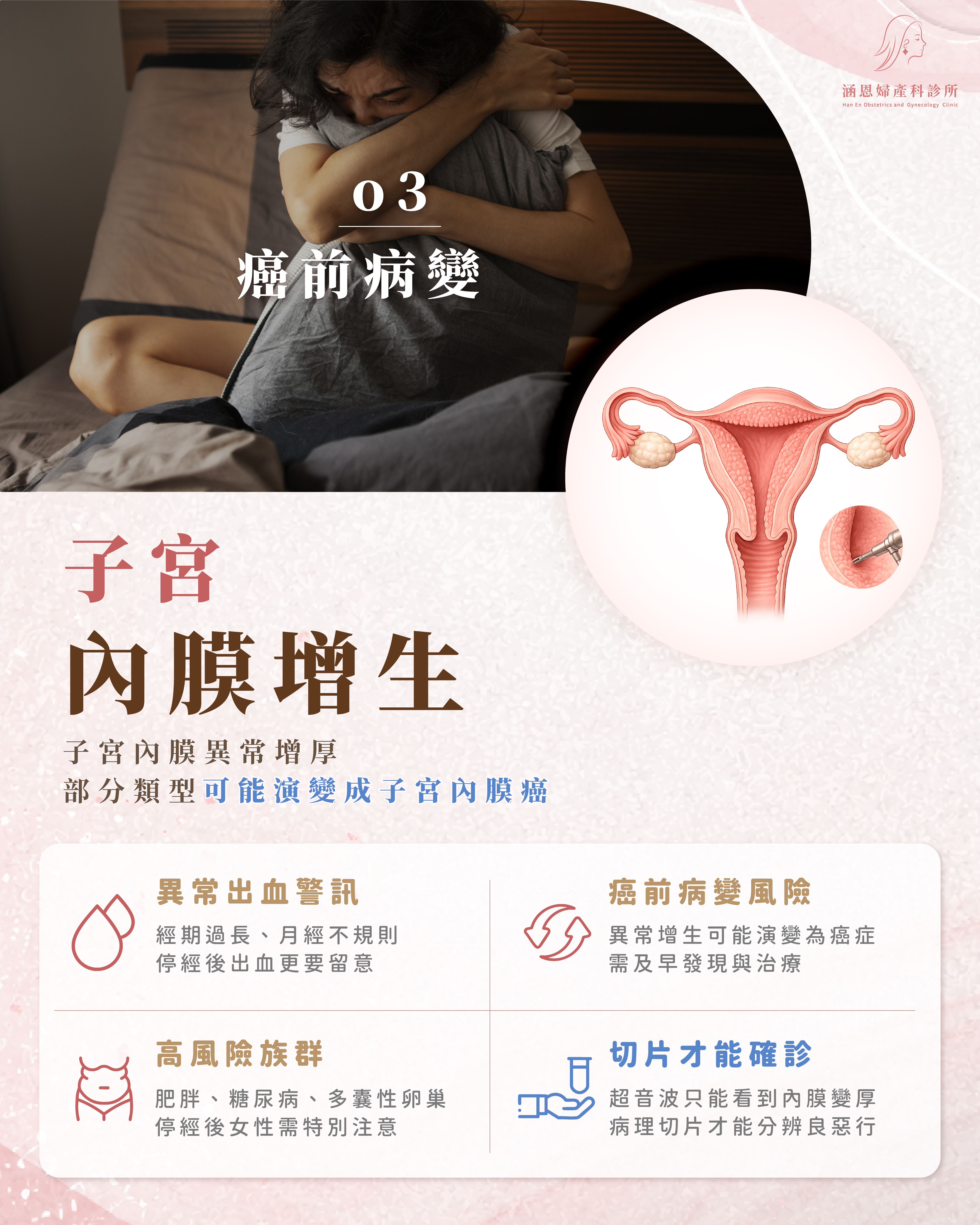 子宮內膜增生示意圖：內膜異常變厚是子宮內膜癌前驅病變
