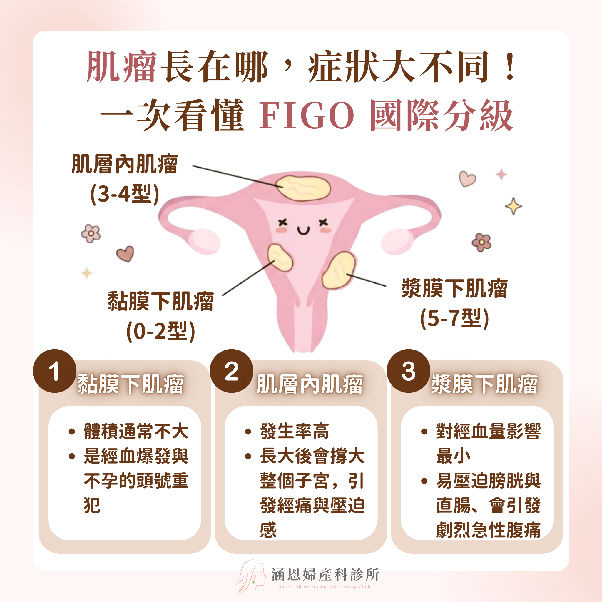 FIGO國際子宮肌瘤分級系統黏膜下肌瘤肌層內肌瘤與漿膜下肌瘤高階超音波診斷