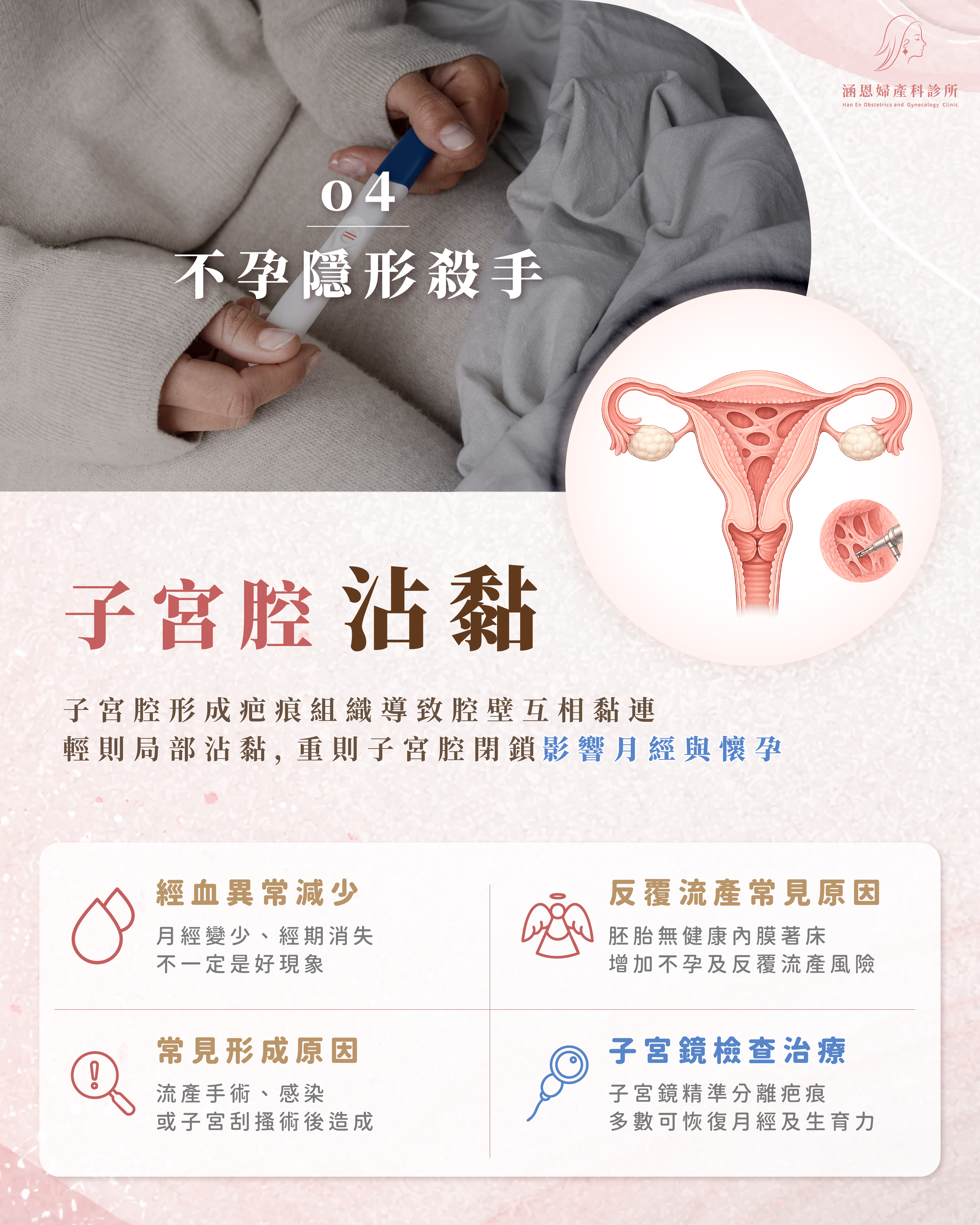 子宮腔沾黏示意圖：疤痕組織封閉子宮腔，是反覆流產的隱形殺手