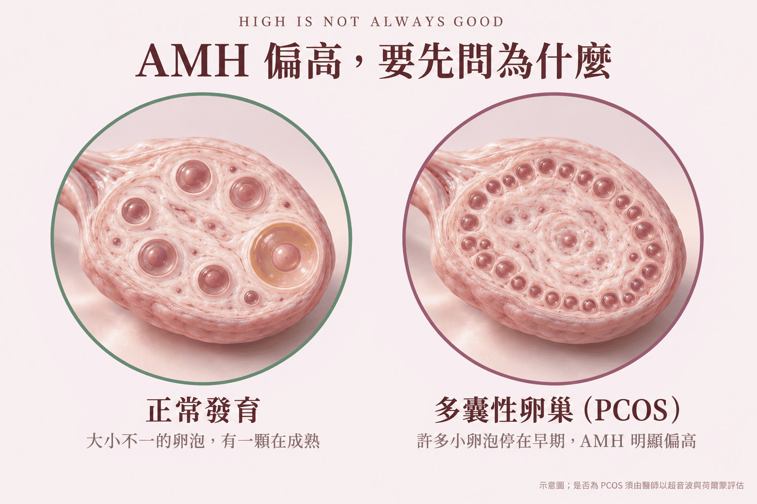 AMH 數值需要醫師結合超音波與整體評估，才能給您最適切的建議。