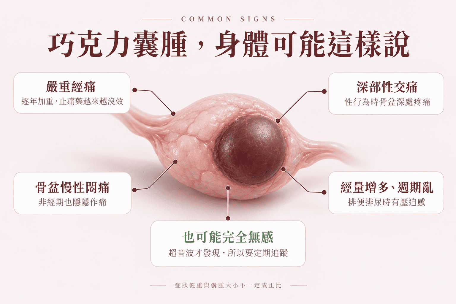 經痛嚴重到影響日常生活，是巧克力囊腫最常見的就醫原因之一