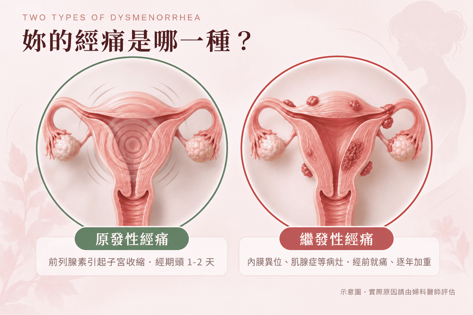 女性抱著熱水袋舒緩經痛的溫柔居家情境