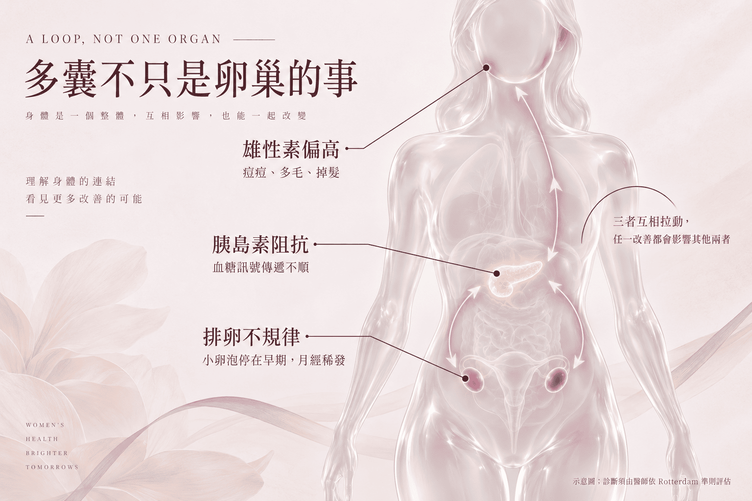 多囊性卵巢症候群是荷爾蒙的失衡，不是妳的錯，也不是妳不夠努力。