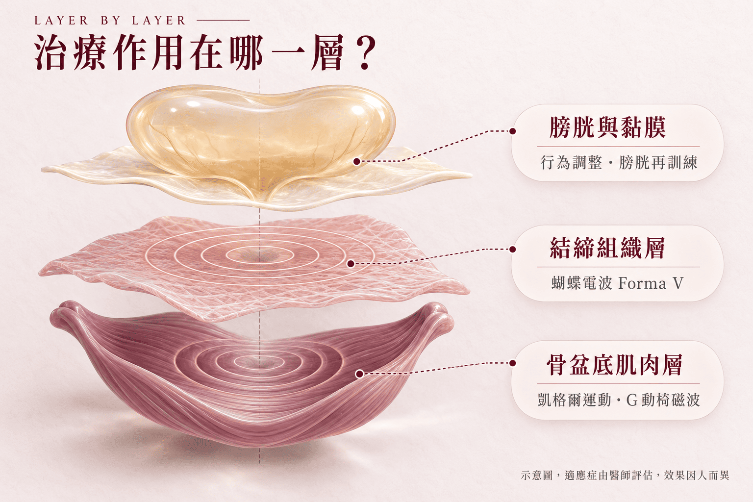 亞洲台灣女性在明亮客廳做骨盆底肌運動，神情專注平靜，象徵自我照顧與尿失禁治療的日常練習